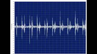 Tracking in HV Insulator Time Series View [upl. by Nalehp]