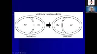 Constrictive vs restrictive Cardiomyopathy by Dr SK PAra [upl. by Ehcsrop]