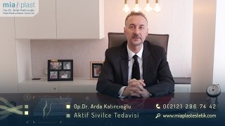 Sivilce Tedavisi  Op Dr Arda Katırcıoğlu [upl. by Regor]