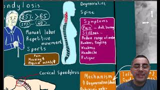 Spondylosis Symptoms causes disease course and treatment [upl. by Ramat552]