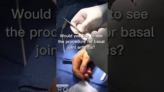 What procedure is needed for basal joint arthritis [upl. by Ardnait]