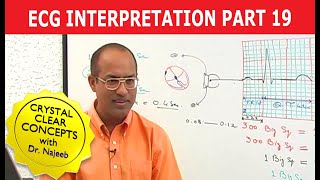 EKG or ECG Interpretation  Part 1920 [upl. by Ziul451]