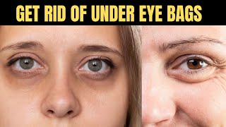 How To Get Rid Of Under Eye Bags [upl. by Addi]