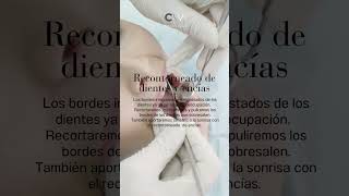 Estética dental en la Clínica Cristina Viyuela  CO [upl. by Eda]