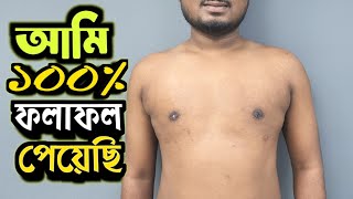 Gynecomastia অপারেশন করে রোগী বলে ১০০ ফলাফল পেলাম [upl. by Nolak]