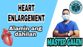 HEART ENLARGEMENT o CARDIOMEGALY Bakit nagkakaroon nito at paano ito maiiwasan [upl. by Hendry]