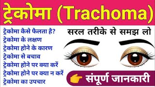 TRACHOMA BY DRPAWAN GUPTA [upl. by Vinn]