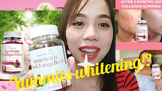 NATURE GLOW GLUTATHIONE COLLAGEN GLOW SKIN WHITENING GUMMIES Ms Sungit [upl. by Tecla]