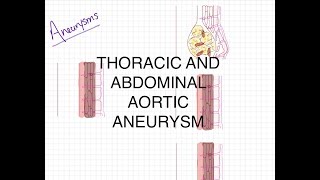 Pathophysiology of Aortic Aneurysms [upl. by Docia]