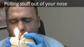 Pulling stuff out of your nose after surgery septoplasty [upl. by Kirred]