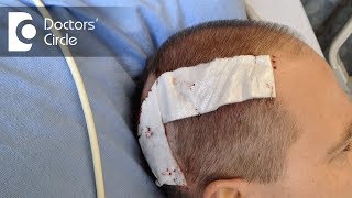 What are the risks in a Craniotomy  Dr Bopanna K M [upl. by Vivi285]