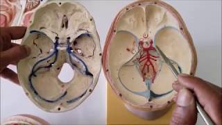 TORCULAR HEROPHILI TRANSVERSE SIGMOID SINUS Tributaries and Clinical Aspects – Sanjoy Sanyal [upl. by Aniara830]