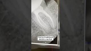 HUGE Abscess Found On Womens CT Scan shorts [upl. by Patrica]