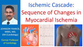 Ischemic cascade Sequence of changes in myocardial ischemia [upl. by Ainotahs]