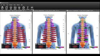 What is The EP Stress Score [upl. by Gobert132]