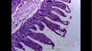 Simple Epithelial Tissuesvideo 1 of 2 [upl. by Salhcin201]