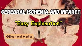 Cerebral ischemia and infarct  Review  CNS pathology  emotionalmedico [upl. by Bertrando]