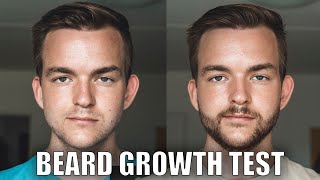 CPH Grooming vs Minoxidil  I tried both Beard Growth [upl. by Carmelita]