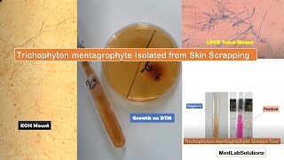 Trichophyton mentagrophyte isolated from clinical sample Skin Scrapping [upl. by Florella705]