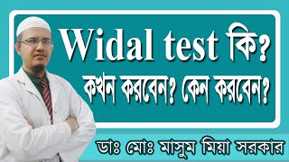 Widal test কিকখন করবেন কেন করবেন [upl. by Diver]