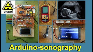 body ultrasound sonography with arduino  Sonographie mit Arduino [upl. by Teiluj]