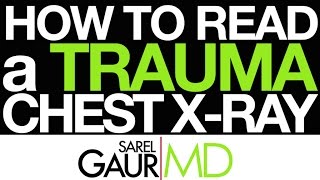 How to Read a Trauma Chest Xray in 3 Minutes [upl. by Aynotahs]