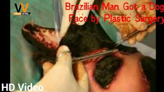 Brazilian Man Got a Dog Face by Plastic Surgery  Viral Vital [upl. by Htnicayh]