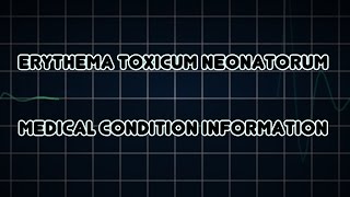 Erythema toxicum neonatorum Medical Condition [upl. by Refinnej]