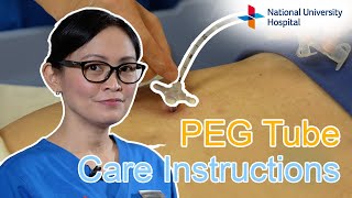 PEG Tube Care Instructions [upl. by Cordie]