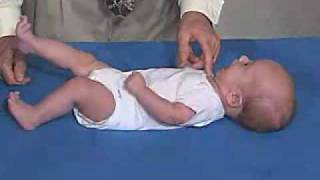 Neurology Exam 3 Month Primitive ReflexesRoot [upl. by Charles]