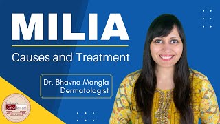 Milia removal treatment  Dermatologist  Skin specialist [upl. by Kriss]