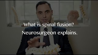 Spinal Fusion and Back Pain Neurosurgeon Explains [upl. by Notlef582]