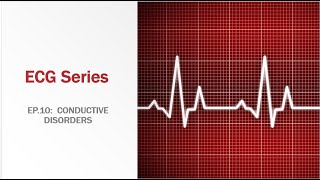 EP10 Conductive disorders [upl. by Harol]