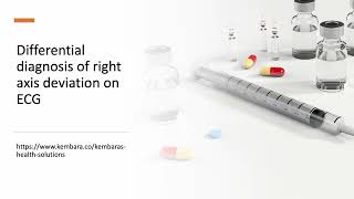 Differential diagnosis of right axis deviation on ECG [upl. by Airal]