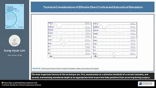 Technical Considerations of Effective Direct Cortical and Subcortical Stimulation [upl. by Orimar701]