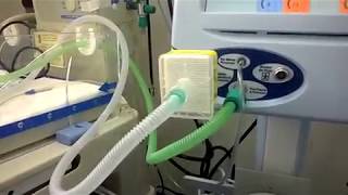 VENTILACION DE ALTA FRECUENCIA OSCILATORIA NEONATAL [upl. by Aerbua]