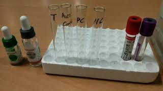 Indirect Coombs test by Tube method [upl. by Assilana]