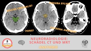 Anatomie im CT und MRT Schädel [upl. by Acceber]