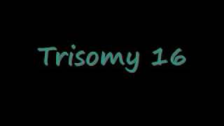 Trisomy 16 [upl. by Kosel]