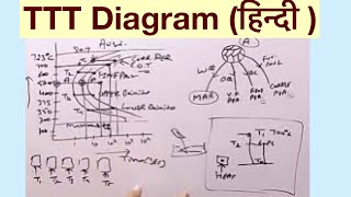 Time Temperature Transformation TTTDiagram हिन्दी [upl. by Nollahp]