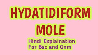 Hydatidiform Mole  We For You OBG MOHIT SIR [upl. by Lombardo]