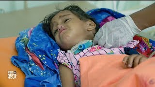 Diphtheria takes a deadly stranglehold on wartorn Yemen [upl. by Airamasor862]