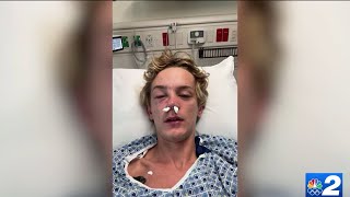 19yearold attacked by stranger outside Pelican Larrys bar near FGCU [upl. by Petty]