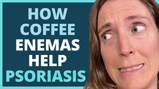 How Coffee Enemas Help Psoriasis Plus Tips You Need to Know [upl. by Garrett443]