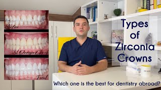 Types of Zirconia Crowns amp Which one is the Best for Dentistry Abroad [upl. by Cass381]