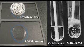 Catalase Test [upl. by Coppins]