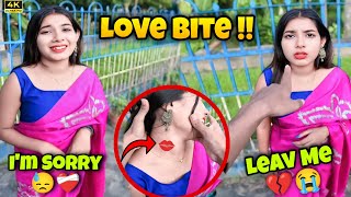 Kissing Prank Gone Wrong💔 Found Love Bite💋🤬Ankur000 [upl. by Salbu]