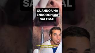 Cuando una ENDODONCIA sale MAL y FRACASA  ¿Te han hecho una endodoncia y ha salido mal [upl. by Oiziruam]