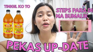 PEKAS O MELASMA UPDATE SECRET PARA DI NA BUMALIKTINIGIL KO NA ANG APPLECIDER VINEGAR [upl. by Anes]