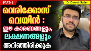 903 🛑 വെരിക്കോസ് വെയിൻ  ഈ കാരണങ്ങളും ലക്ഷണങ്ങളും അറിഞ്ഞിരിക്കുക Varicose Vein Causes amp Symptoms [upl. by Nguyen]